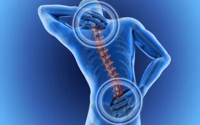 Back Pain After Deadlifts? Read This Before You Skip Leg Day
